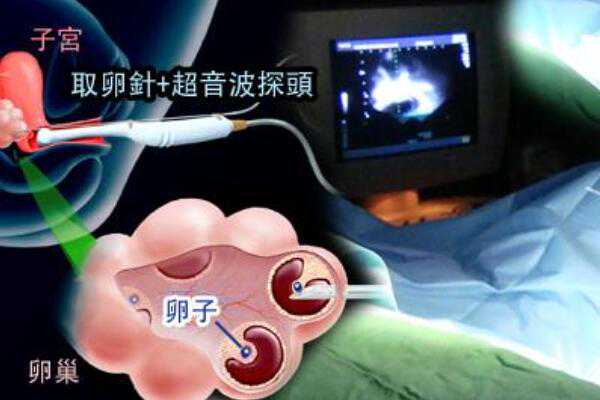 (a)代孕生子电话,2023湘潭三代试管婴儿生混血婴儿价格公示，不同医院差异化较